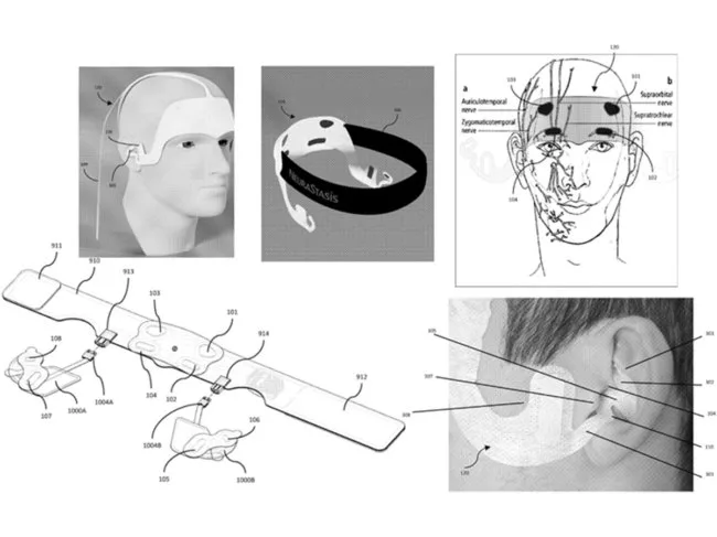 neurostasis neurostimulator